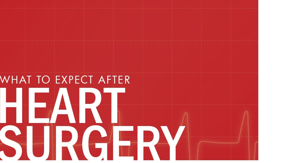 what to expect after heart surgery